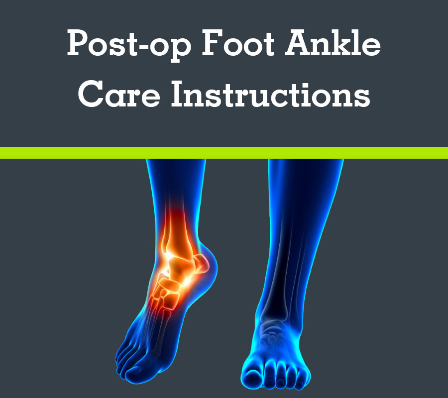 Post-op Foot Ankle Care Instructions