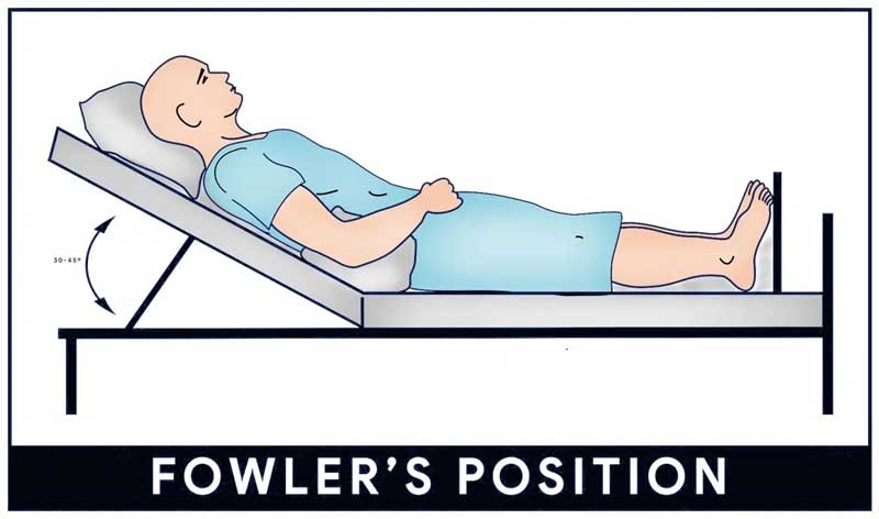 The Complete Guide for Patient Positioning - Healthcare Supply