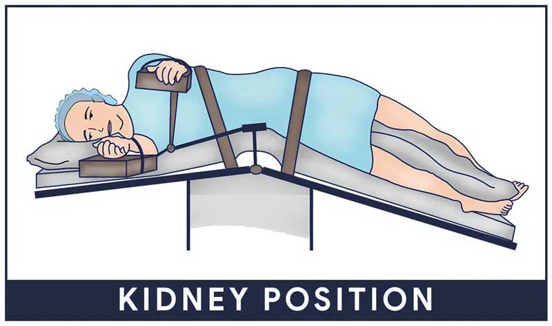 Patient positioning 1 - Supine position 