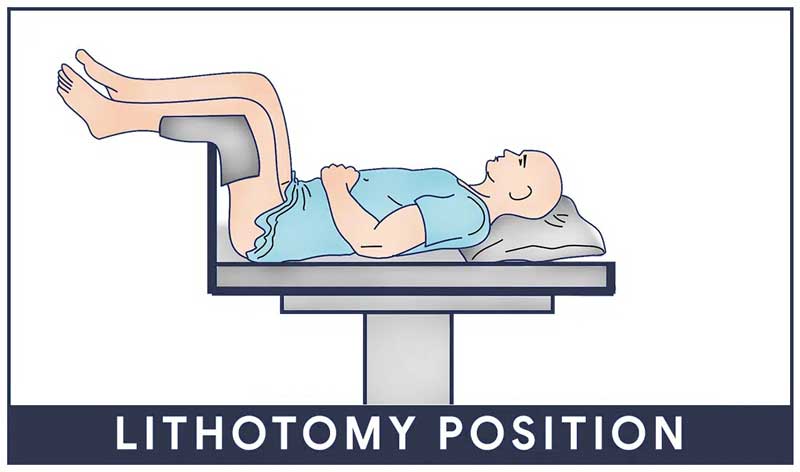 The Complete Guide for Patient Positioning - Healthcare Supply