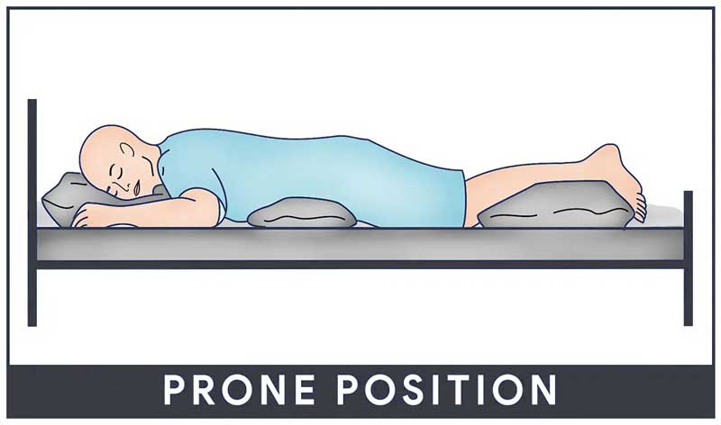 Supine position for casting